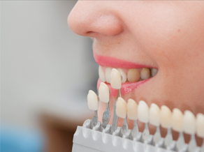 Teeth Whitening